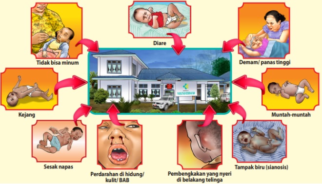 Membersihkan Mulut Bayi